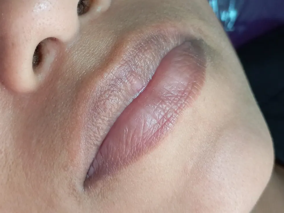 Lábios antes do Hydra Gloss